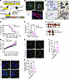 Decelerated mammary tumor growth but unchanged tumor onset and tissue macro