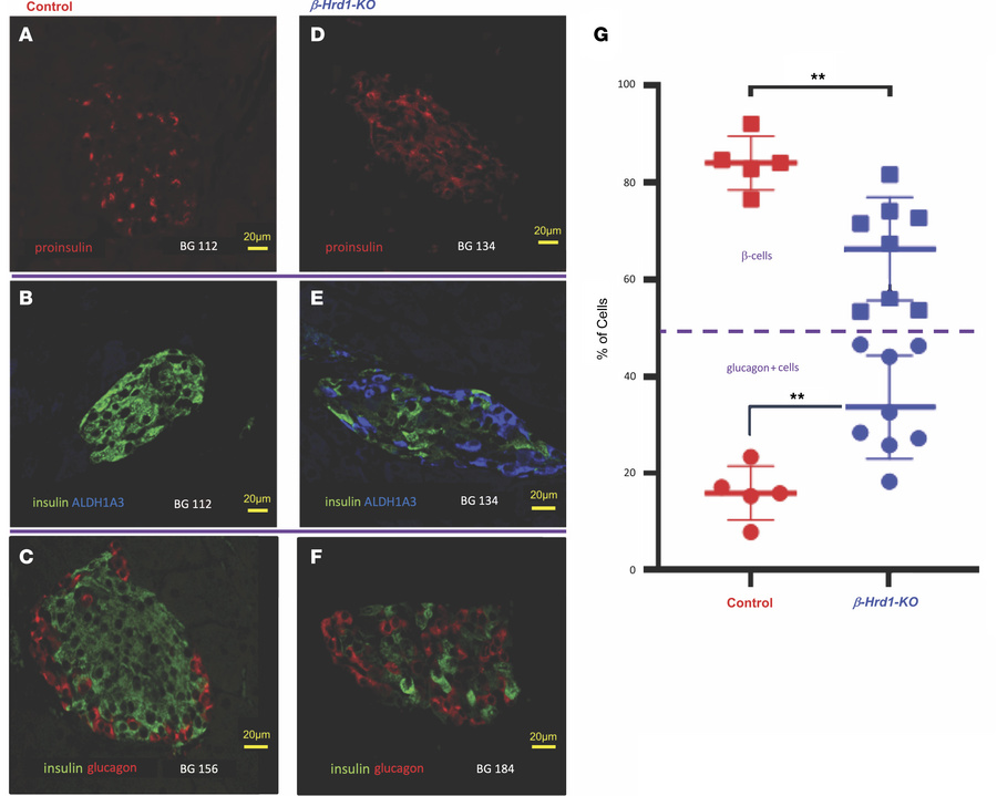 Proinsulin, insulin, ALDH1A3, and glucagon in pancreatic tissue sections...