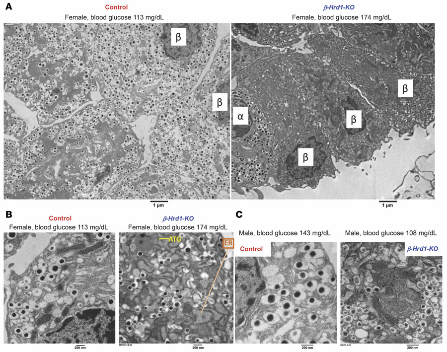 Electron microscopy of β-Hrd1–KO islet sections.
(A) Low-power transmiss...