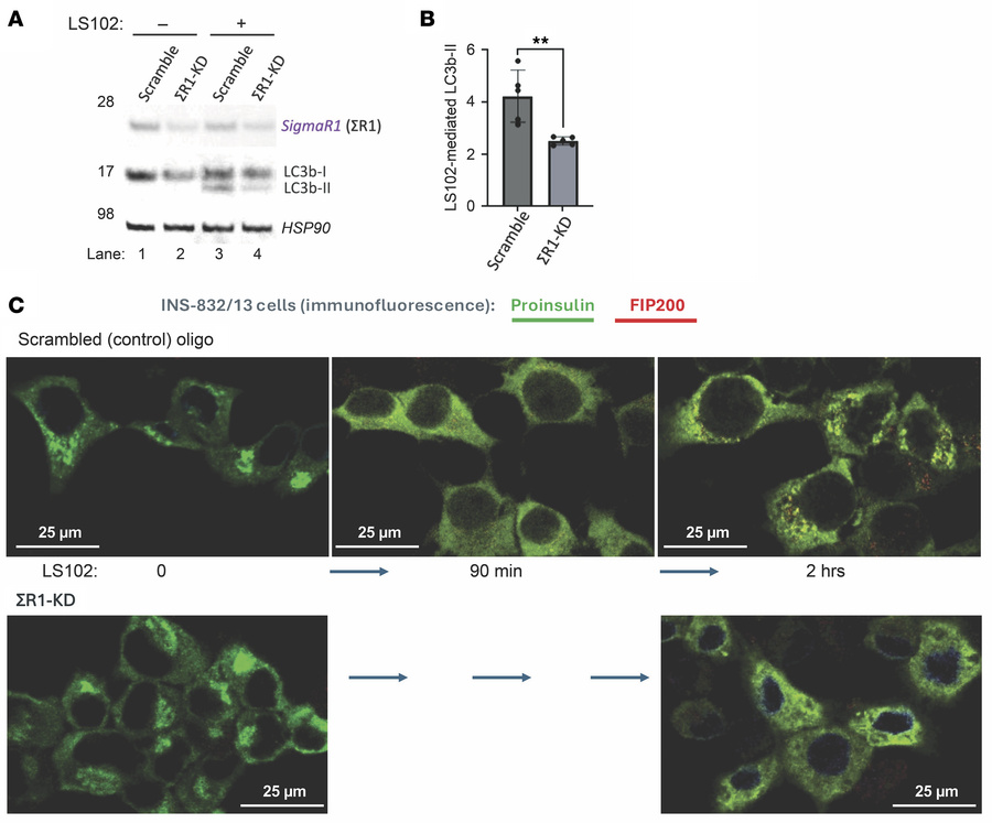 Effects of ΣR1 and LS102 on LC3, and proinsulin distribution in INS1 cel...