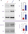 Steady-state levels of BiP, p58ipk (ERdj6), and phospho-eIF2α in islets of