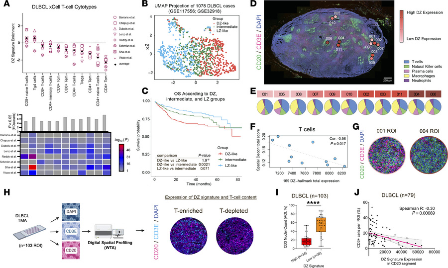 The GC DZ spatial signature in aggressive B cell lymphomas is associated...