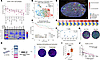 The GC DZ spatial signature in aggressive B cell lymphomas is associated wi