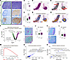 The spatial signature of DZ cells is independent of AICDA-related mutationa