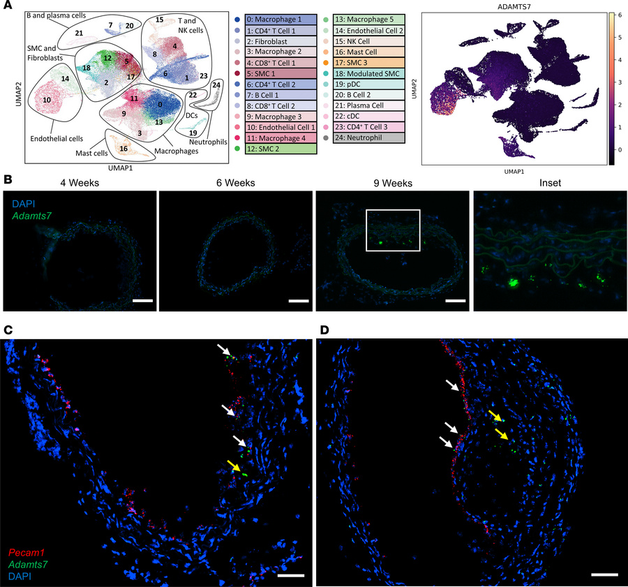 Identifying endogenous ADAMTS7 expression.
(A) scRNA-seq of human caroti...