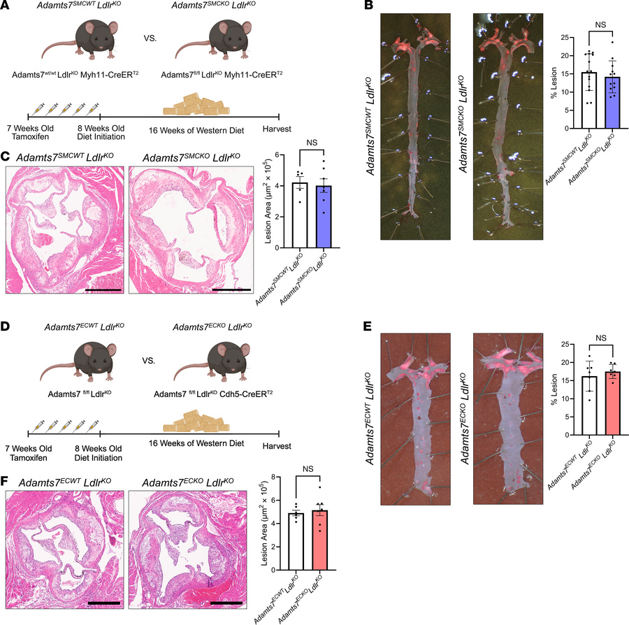 SMC or EC KO of Adamts7 does not affect atherosclerosis.
(A) Schematic o...