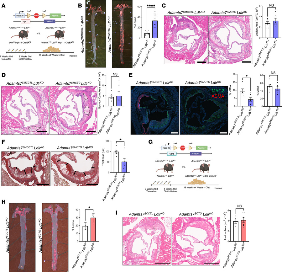SMC and EC transgenic Adamts7 increases aortic atherosclerosis.
(A) Sche...
