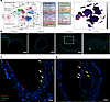 Identifying endogenous ADAMTS7 expression.
