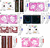 SMC and EC transgenic Adamts7 increases aortic atherosclerosis.