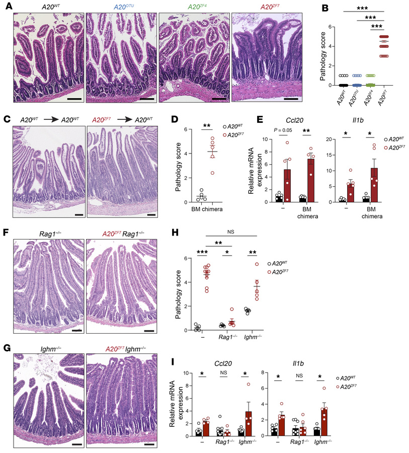 
A20ZF7 restrains small intestinal enteritis that is T cell dependent.
(...