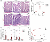 IL-17A protects against and IL-22 promotes small intestinal enteritis in A2