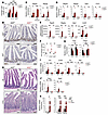IL-22 disrupts epithelial barrier integrity and drives microbe-dependent en