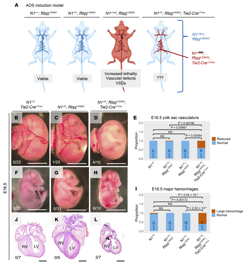 Conditional removal of one copy of Notch1 from the vascular endothelium ...