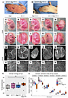 N1+/null Rbpj+/E89G,fl embryos display vascular phenotypes.