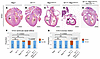Conditional removal of RbpjE89G from the vascular endothelium rescues heart