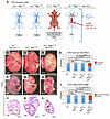Conditional removal of one copy of Notch1 from the vascular endothelium of