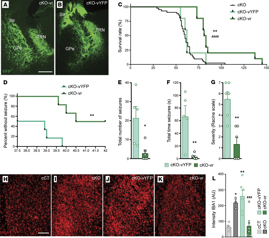 Reexpression of Ndufs4 in Gad2-expressing GPe neurons reduces epilepsy a...