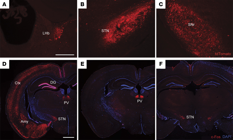 Activation of the STN during fatal epileptic events.
(A–C) TdTomato labe...
