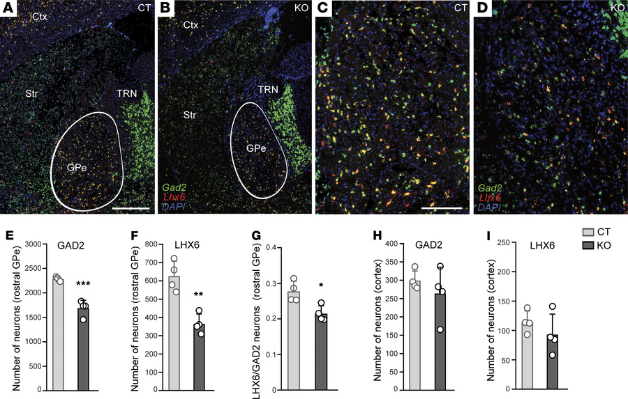 Reduced number of Gad2- and Lhx6-expressing neurons in the rostral GPe o...