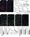 Loss of Lhx6-expressing GABAergic neurons in the rostral GPe of cKO mice.