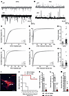 Altered pallido-subthalamic projections participate in the development of s