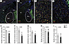 Reduced number of Gad2- and Lhx6-expressing neurons in the rostral GPe of K