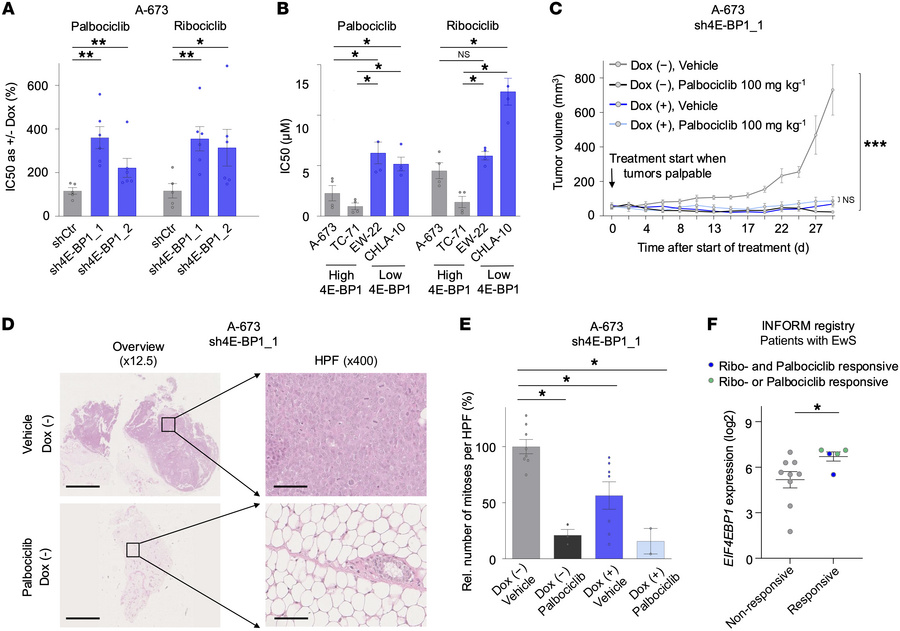 High 4E-BP1 expression sensitizes to targeted CDK4/6 inhibitor treatment...