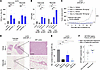 High 4E-BP1 expression sensitizes to targeted CDK4/6 inhibitor treatment wi