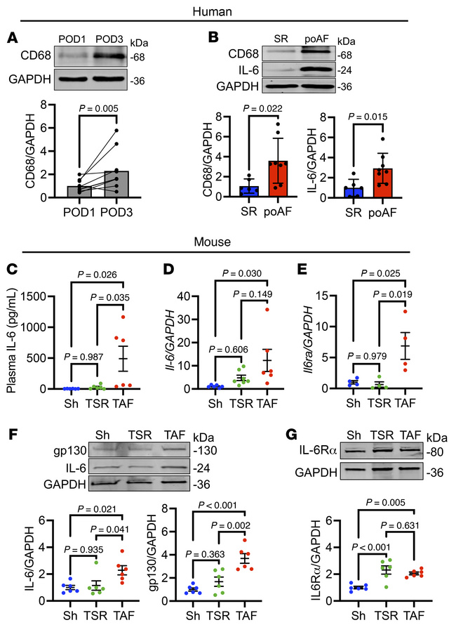 Atrial IL-6 signaling is increased in poAF.
(A) Paired human PF samples ...