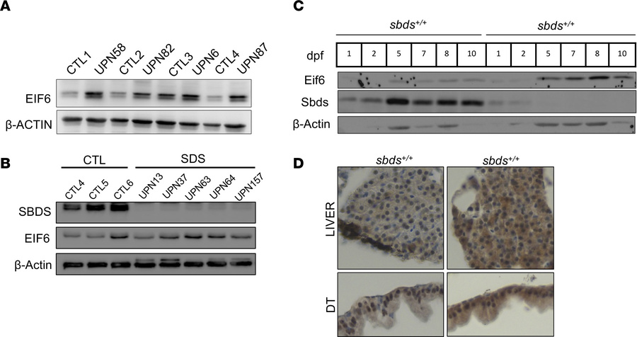Eif6 accumulation in patients with SDS and sbds-KO zebrafish.
Western bl...