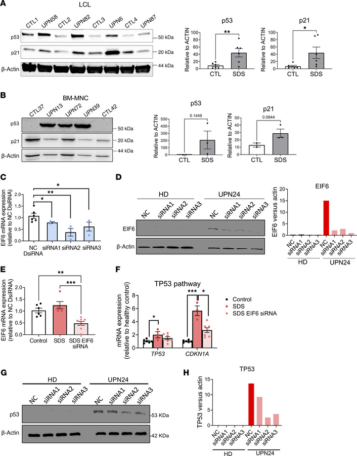 Tp53 activation in SDS patient–derived cells.
Western blots and quantifi...