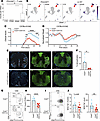 OCA-B loss protects animals from chronic EAE.