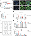 OCA-B is dispensable for T cell response to CNS infection with a neurotropi