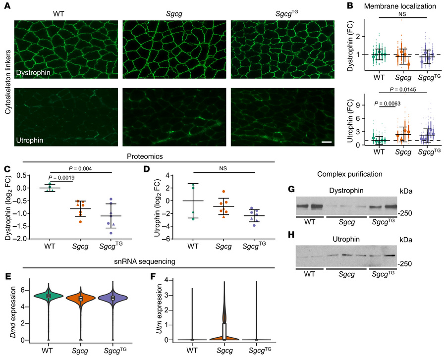 SSPN restores dystrophin-dystroglycan association.
(A) Immunofluorescenc...
