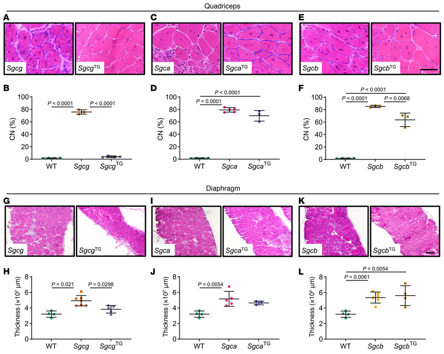 SSPN ameliorates central nucleation and reduces dystrophic pathology in ...