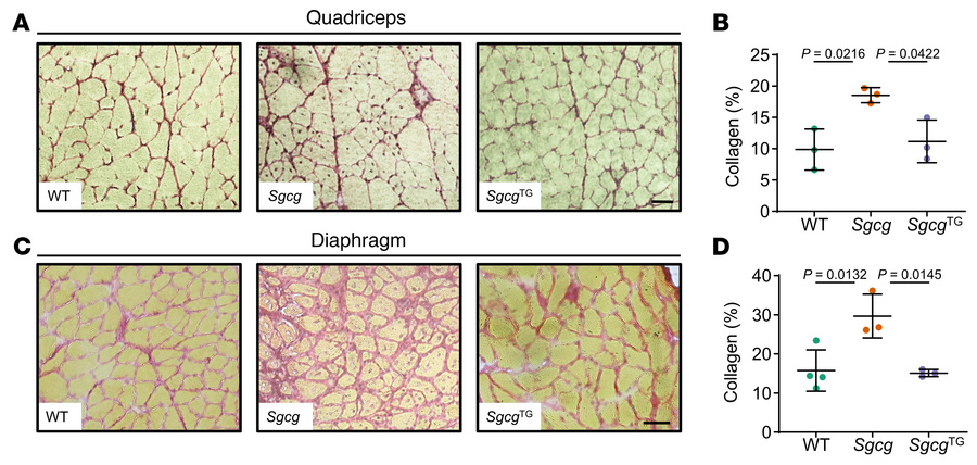 Fibrosis is prevented in SgcgTG muscle.
Transverse cryosections and quan...