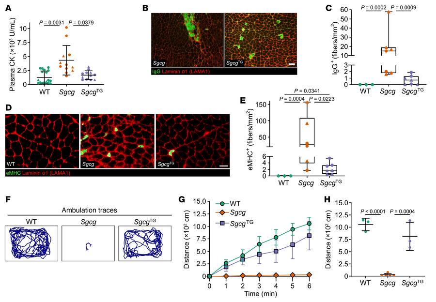 SSPN reduces membrane damage and improves muscle physiology in Sgcg mice...