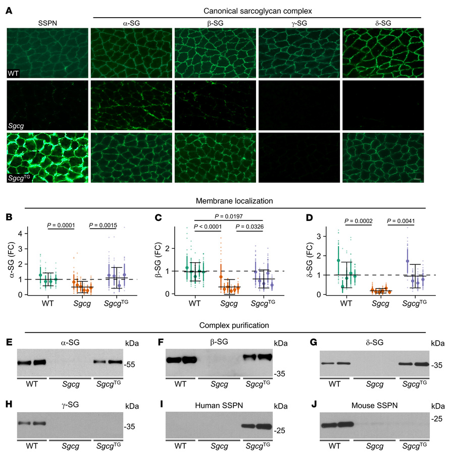 SSPN restores membrane expression protein interactions of α-, β- and δ-s...