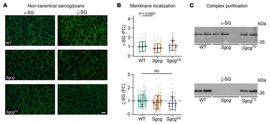 SSPN stabilizes DGC complexes containing ζ-sarcoglycan.
(A) Indirect imm...