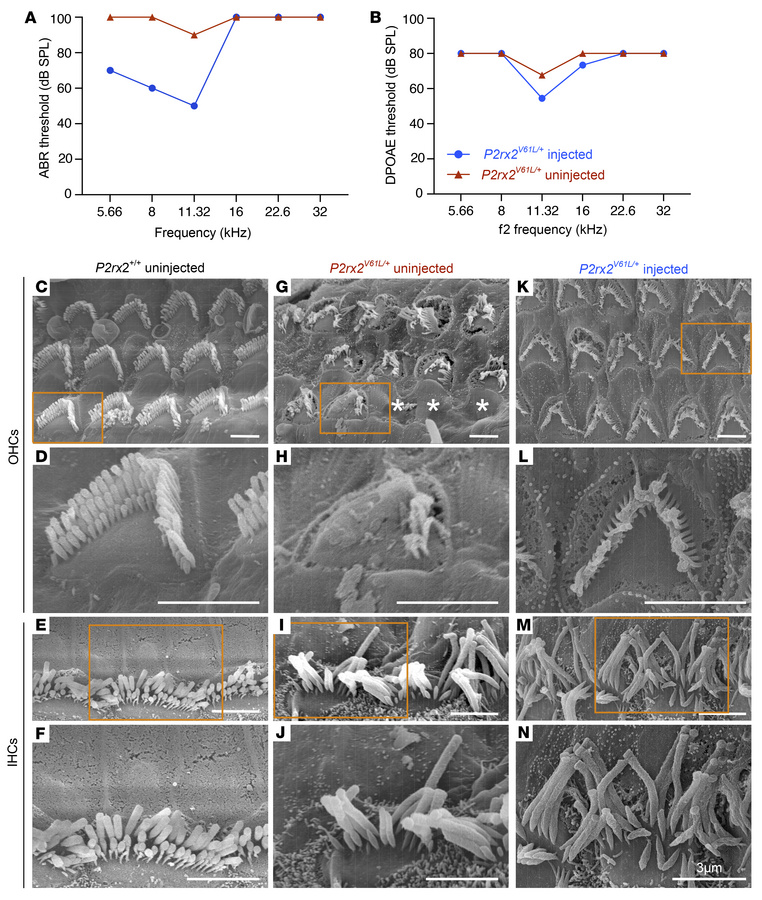 AAV2–SaCas9–sgRNA-1 rescues HC morphology in the P2rx2V61L/+ mouse model...