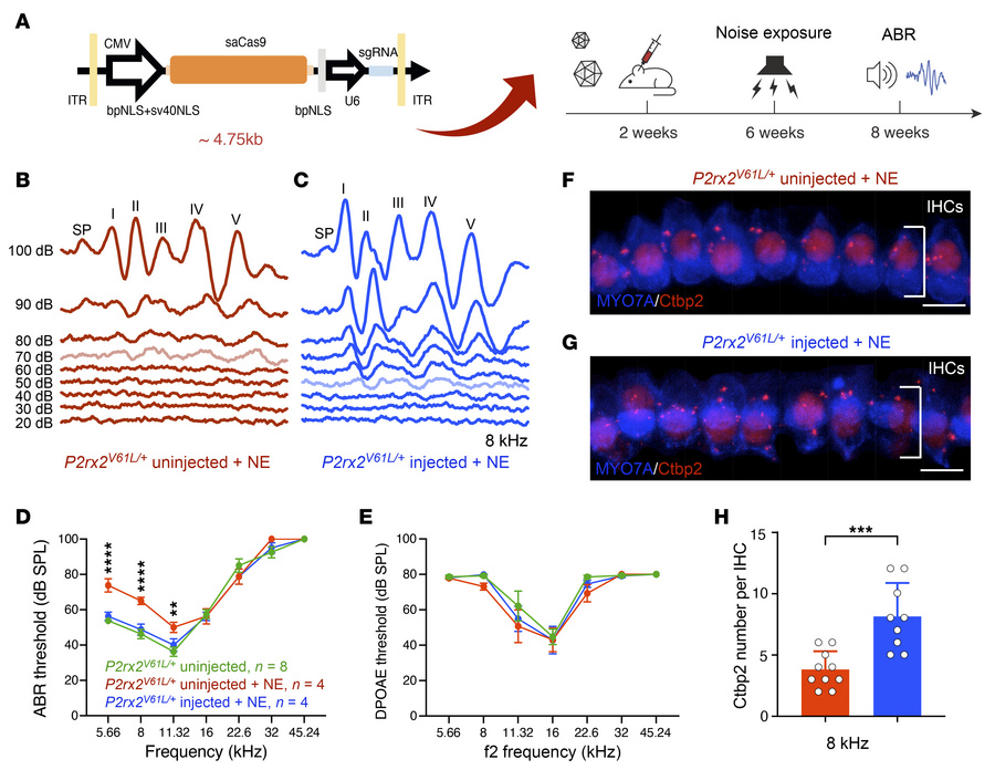 AAV2–SaCas9–sgRNA-1 injection attenuates increased sensitivity to NIHL i...