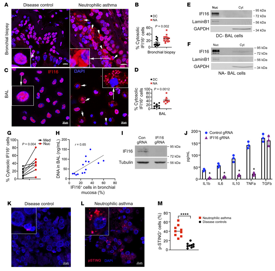Cytosolic IFI16 and activated STING in NA.
(A–D) Representative image of...
