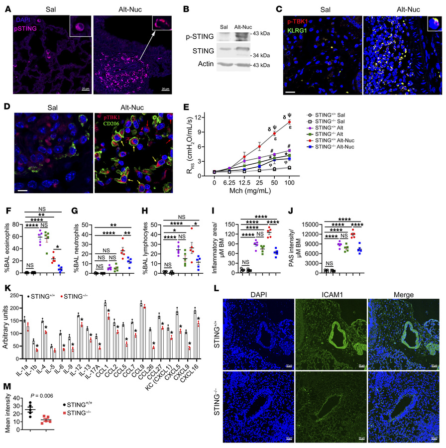 Role of STING in the Alt-Nuc and Alt models of asthma.
(A) Expression of...