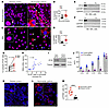 Cytosolic IFI16 and activated STING in NA.