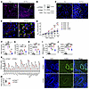 Role of STING in the Alt-Nuc and Alt models of asthma.
