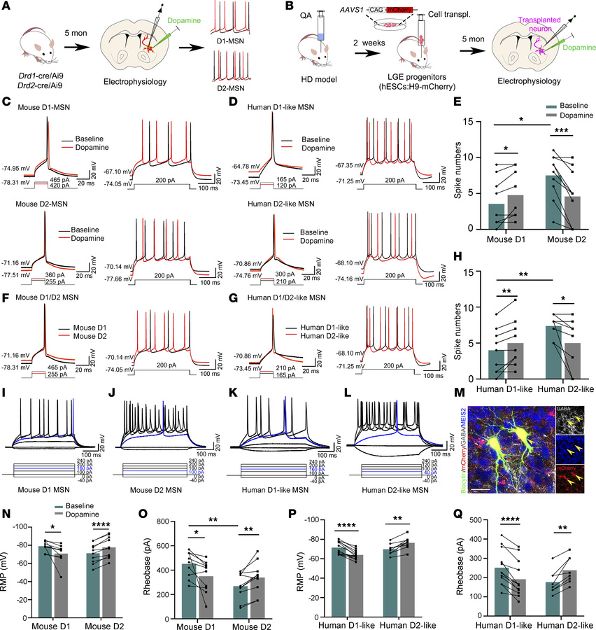 Neuromodulation of striatal MSN by DA in transgenic mice and human graft...