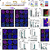 Generation and characterization of LGE progenitors derived from hESCs.