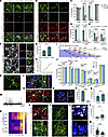Generation and characterization of striatal MSN subtypes from hESCs by 3D-d