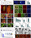 Neuron maturation and neural circuit reconstruction of grafted striatal neu