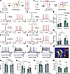 Neuromodulation of striatal MSN by DA in transgenic mice and human graft in